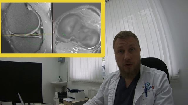 Разрыв мениска | диагностика