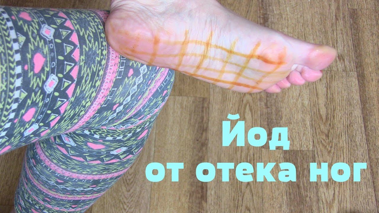 Как избавиться от ОТЕКА НОГ с помощью йода. смотреть онлайн