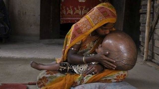 Топ 5 аномалий людей.Жуть!!! смотреть онлайн