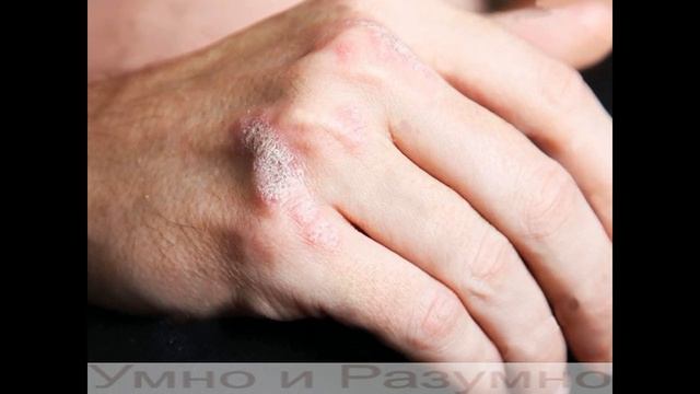 Грецкие орехи, вот в чём их польза и вред смотреть онлайн