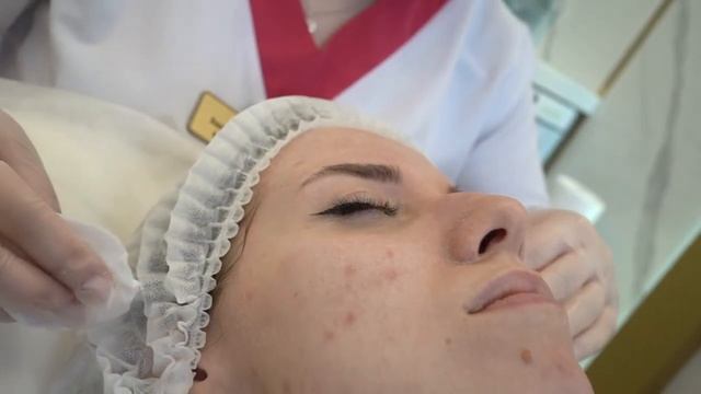 Косметологическая клиника «Доктор Зайка», Пилинг Золушки смотреть онлайн