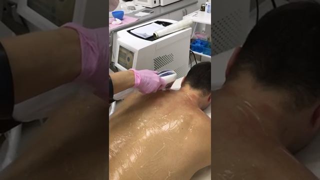 Центр лазерной эпиляции смотреть онлайн