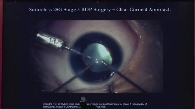 AIOC2020 - IC25 -Retina Grand Rounds –Interactive смотреть онлайн