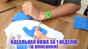 ОГРОМНЫЕ ЧЕРВИ ПОД КОЖЕЙ ДЕВУШКИ, УДАЛЕНИЕ