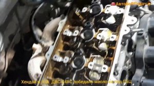 течь масла и антифриза  из под ГБЦ двигателя G4FC хендай и киа