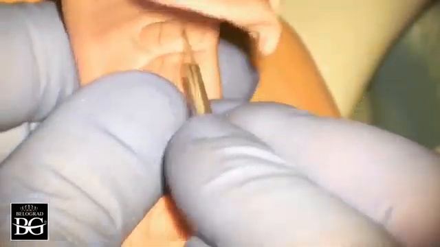 Silicone Index To Control Prep For Veneers. Силиконовый ключ