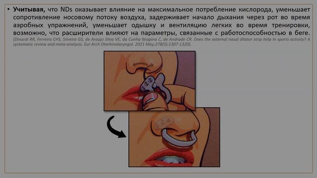 НОСОВОЙ РАСШИРИТЕЛЬ ДЛЯ ПОВЫШЕНИЯ РАБОТОСПОСОБНОСТИ В БЕГЕ смотреть онлайн