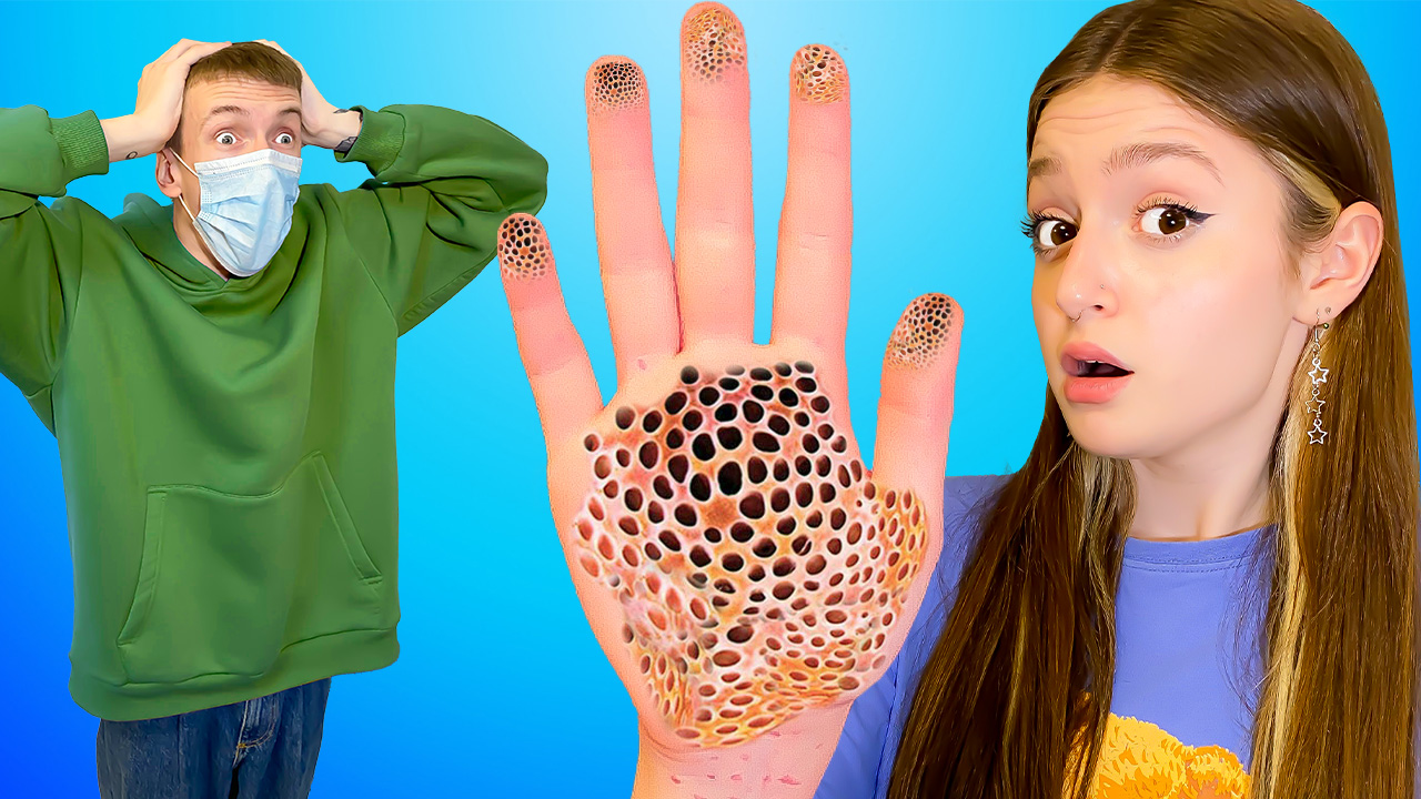 ЗАБОЛЕЛА СЕРЬЕЗНОЙ БОЛЕЗНЬЮ! Как не заразить друга?!