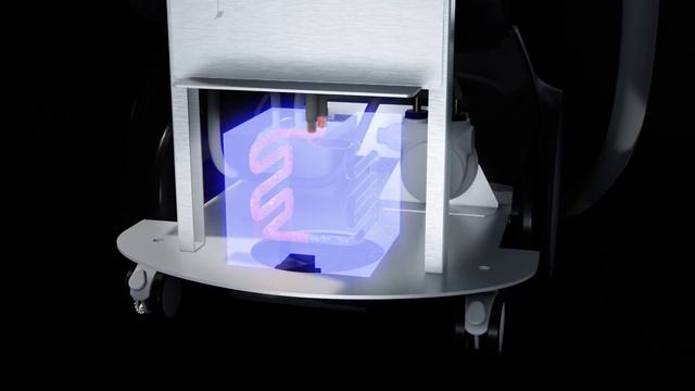 MLG LASER эпиляция нового поколения смотреть онлайн