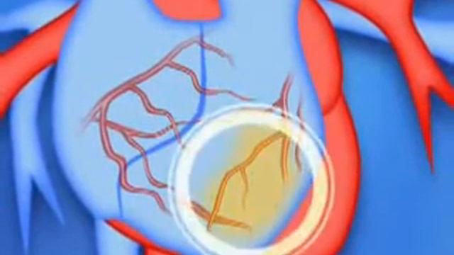 Мультфильм Защити свою кровеносную систему смотреть онлайн