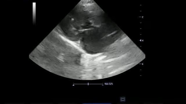 Кот перс 8 месяцев ГКМП обструктивная форма смотреть онлайн