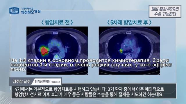 Только 40% пациентов с раком легких могут оперироваться - профессор Ким Чжу Сан смотреть онлайн