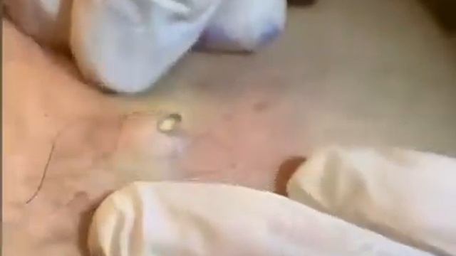 satisfying video, черные точки выдавливание черных точек, удовольствием, кайф для глаз😍 смотреть онлайн