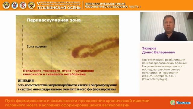 Захаров Пути формирования и возможности преодоления хронической ишемии головного мозга смотреть онлайн