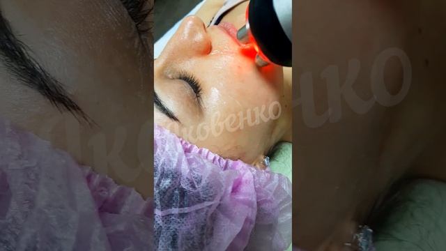 rf- лифтинг для лица смотреть онлайн