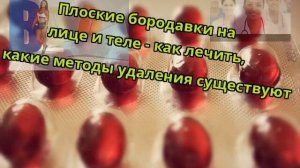 Плоские бородавки на лице и теле - как лечить, какие методы удаления существуют