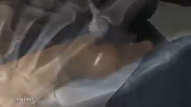 Австралиец внедрил себе в руку микрочип для расширения возможностей использования смартфона смотреть онлайн