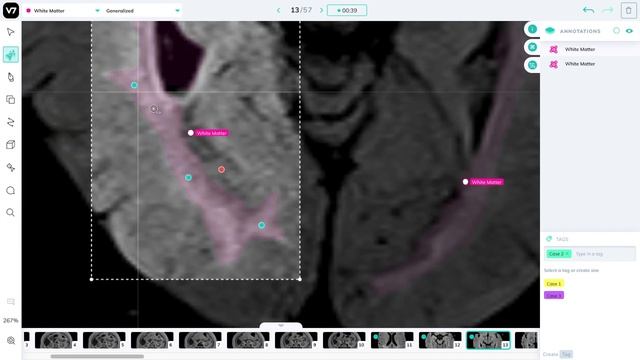 MRI and CT Image Annotation - V7 AI Academy смотреть онлайн