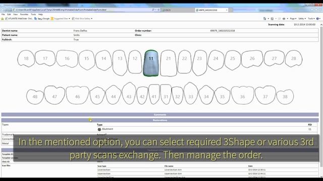 TRIOS & 3rd Party Software Scans Import Workflow in #3Shape смотреть онлайн
