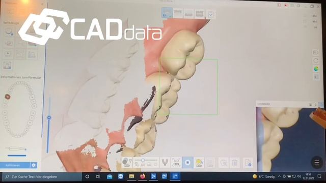Medit i700. Part 3. Scanning. смотреть онлайн