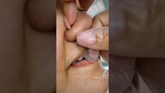 Волосы в носу, как их убрать! Hair in nose смотреть онлайн