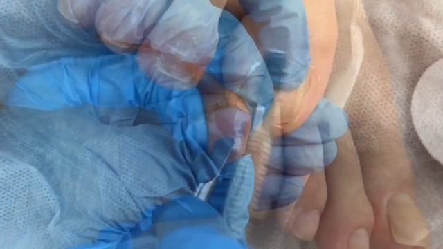 Гель для размягчения кутикулы ног - способ применения смотреть онлайн
