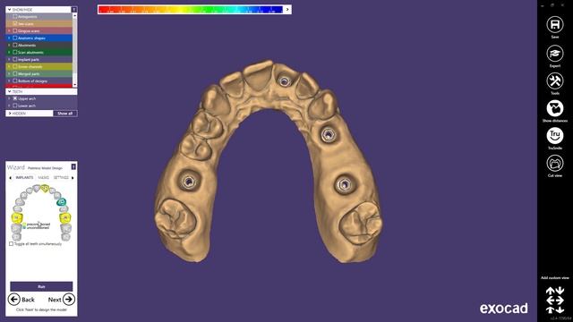 exocad Quick Guide: Implant Model смотреть онлайн