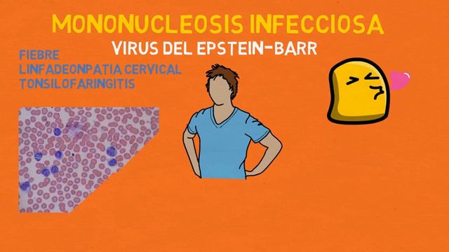 MONONUCLEOSIS - Virus del Epstein-Barr: Enfermedad del beso. смотреть онлайн