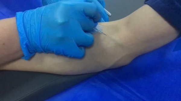 Как установить периферический венозный катетер