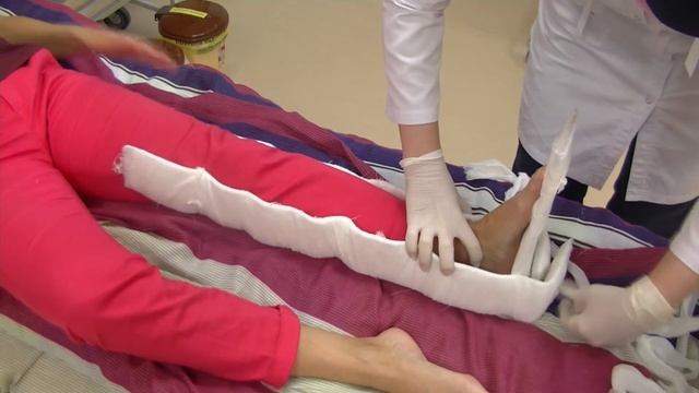 Иммобилизация нижней конечности транспортной шиной Крамера смотреть онлайн