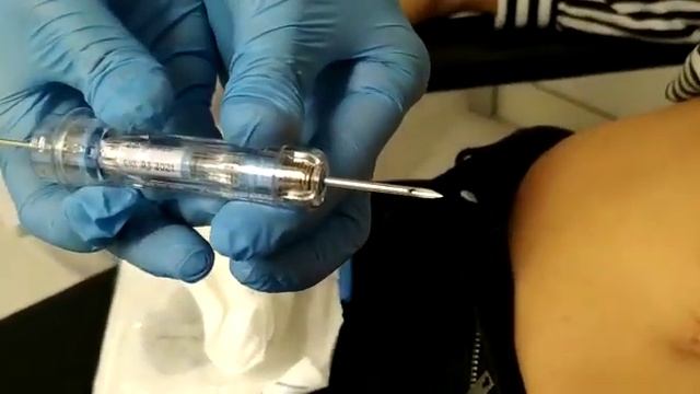 Pinchazo de Zoladex www.positivitycancer.com смотреть онлайн