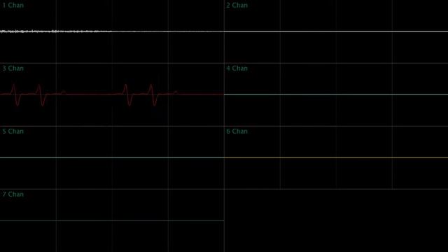 EarthBound - Pokey Means Business/Cease to Exist (Oscilloscope Deconstruction) смотреть онлайн
