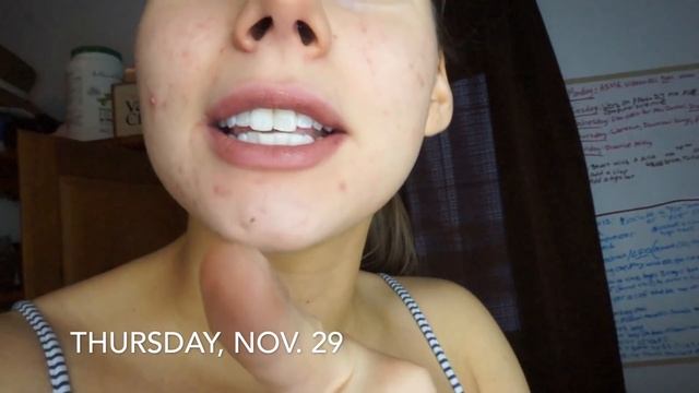 THE PUMPKIN ENZYME MASK TEST || Banish Skincare || Brighten acne scars and improve skin texture! смотреть онлайн