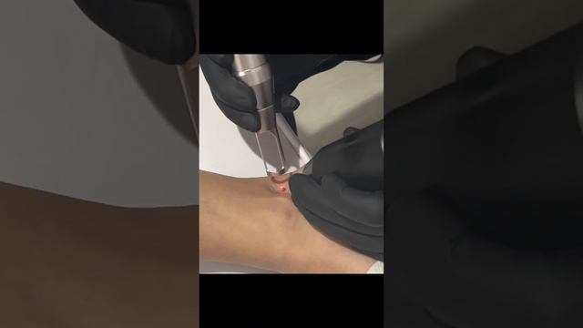 Ankle Heart смотреть онлайн