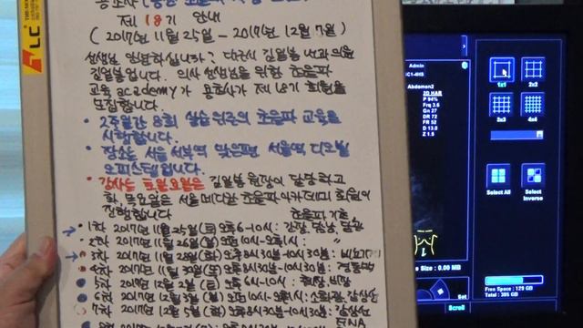 김일봉 원장 동영상 초음파 증례토의(342)①좌측 간엽 저형성 ②지방간 ③좌측 신낭종(M/56) смотреть онлайн