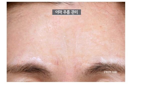 Carecella смотреть онлайн