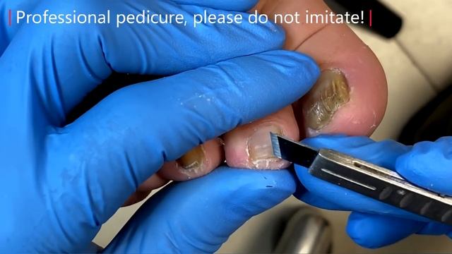 Pedicure Tutorial: Complete Toenail Care【Xue Yidao】 смотреть онлайн