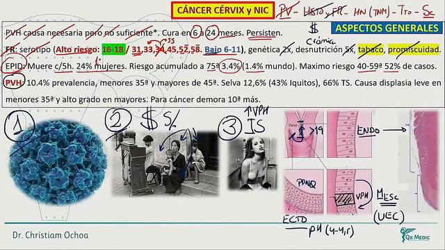 Ginecología - SD DAB EPI CANCER Cervix y NIC parte 1 смотреть онлайн