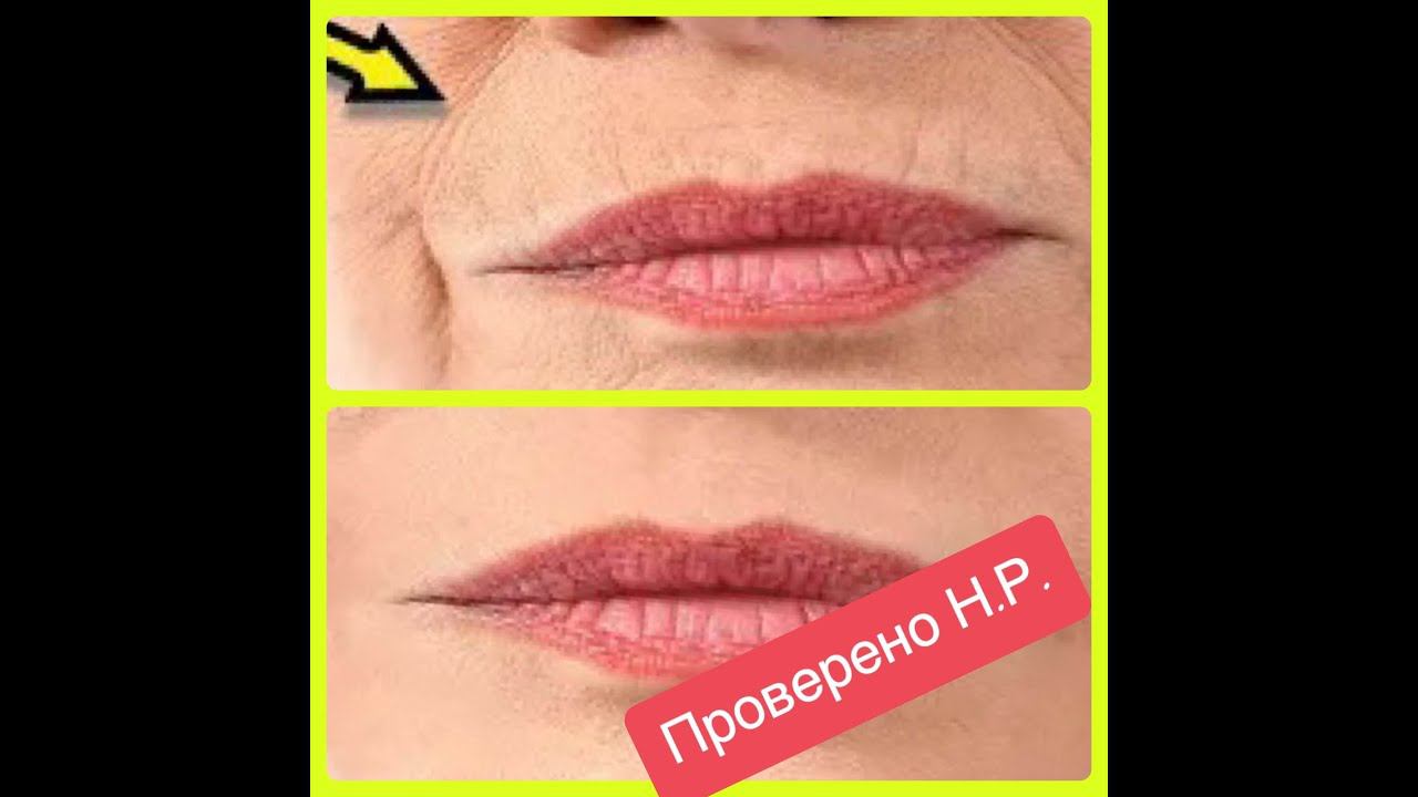 ПРОВЕРЕНО! " Волшебная сыворотка сильнее ботокса, подтягивает кожу и убирает морщины."ЧЕСТНЫЙ ОТЗЫВ. смотреть онлайн