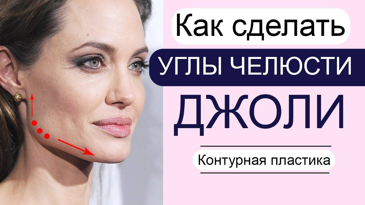 Как сделать углы челюсти ДЖОЛИ филлерами / Профиль Джоли / Контурная пластика смотреть онлайн