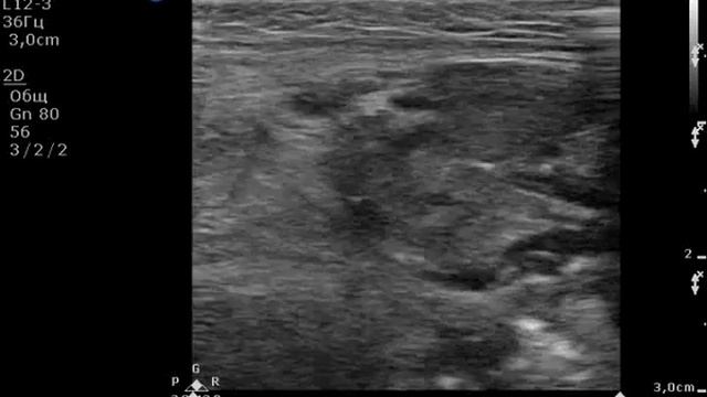 Тайные рецепты мышц