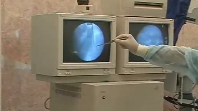 Лазерная реконструкция позвоночных дисков © Laser reconstruction of intervertebral discs смотреть онлайн