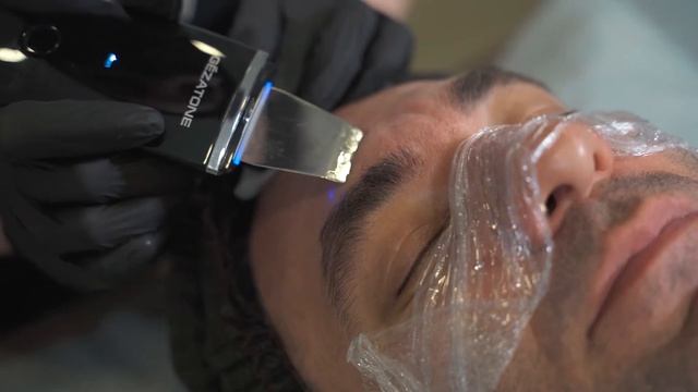 Ультразвуковая чистка лица и всесезонный миндальный пилинг Medic Control Peel смотреть онлайн