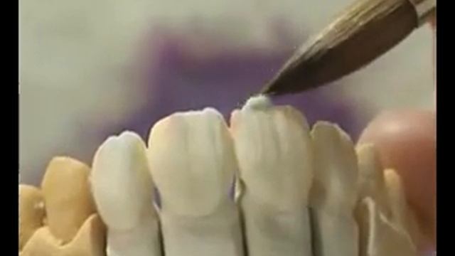 Виниры flv смотреть онлайн