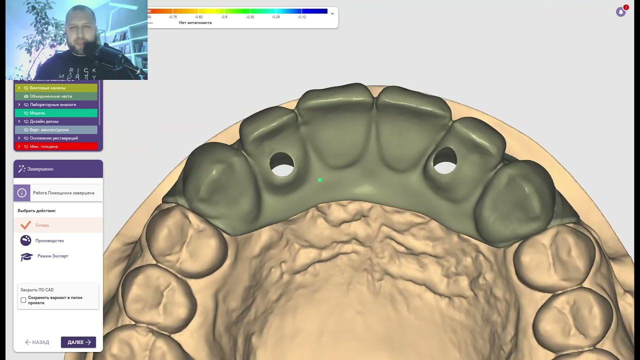 Разбор работ проверка заданий Курсы зубных техников смотреть онлайн