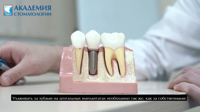 Дентальная имплантация. Срок службы дентальных имплантатов. смотреть онлайн