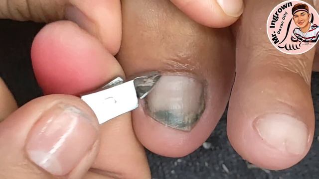 PART2 SUBRANG MABASA ANG LUPA AT MABAHO