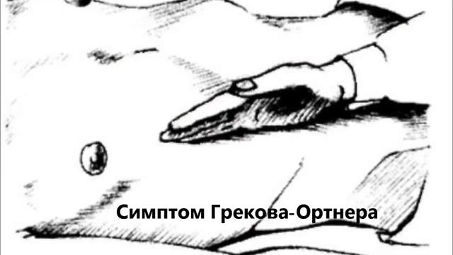 Симптомы поражения желчного пузыря (пузырные симптомы). Как их проверить у ребенка. смотреть онлайн