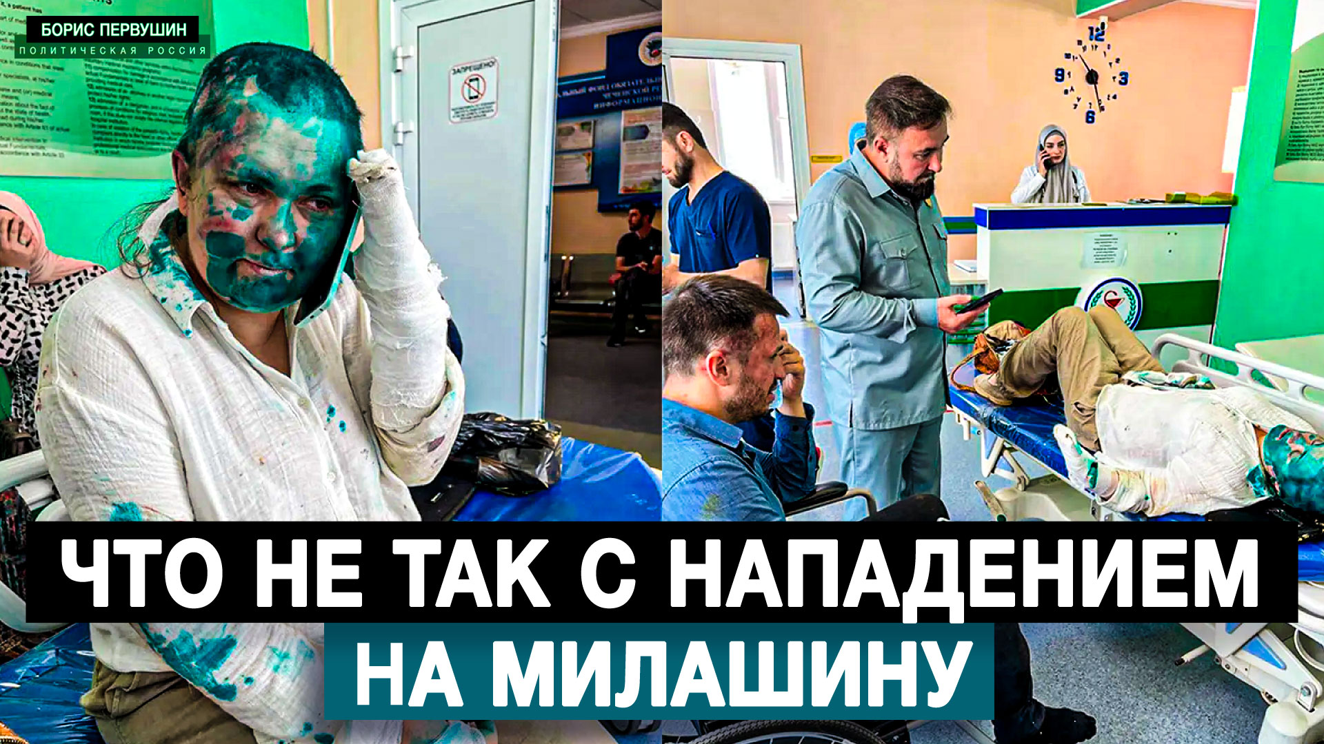 БОРИС_Что не так с нападением на Милашину