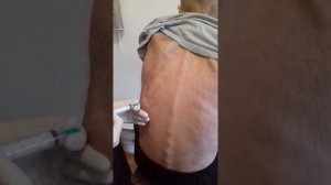 Пункция плевральной полости ОМОКБ